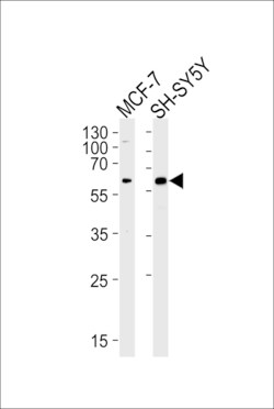Invitrogen ZBTB22 Polyclonal Antibody 400 &mu;L; Unconjugated:Antibodies,