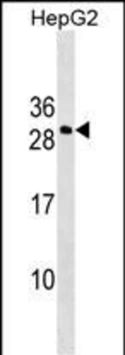 Invitrogen DDIT4L Polyclonal Antibody 400 &mu;L; Unconjugated:Antibodies,
