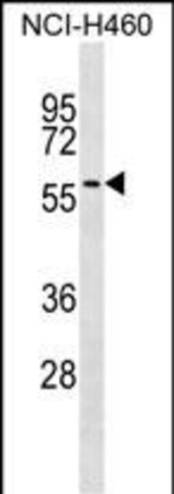 Invitrogen UGT2A3 Polyclonal Antibody 400 &mu;L | Buy Online | Invitrogen&trade; | Fisher Scientific