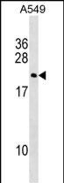 Invitrogen DUX3 Polyclonal Antibody 400 &mu;L; Unconjugated:Antibodies,