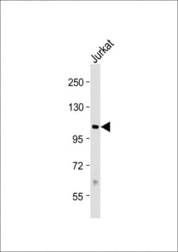 Invitrogen PRMT9 Polyclonal Antibody 400 &mu;L; Unconjugated:Antibodies,
