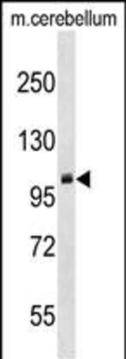 Invitrogen PRMT9 Polyclonal Antibody 400 &mu;L; Unconjugated:Antibodies,