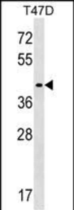 Invitrogen MMADHC Polyclonal Antibody 400 &mu;L; Unconjugated:Antibodies,
