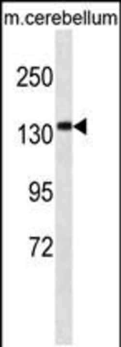 Invitrogen CAMSAP3 Polyclonal Antibody 400 &mu;L | Buy Online | Invitrogen&trade; | Fisher Scientific