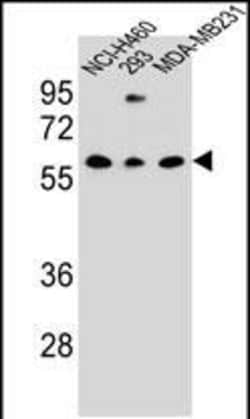 Invitrogen CLEC17A Polyclonal Antibody 400 &mu;L; Unconjugated:Antibodies,