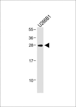 Invitrogen IGLL5 Polyclonal Antibody 400 &mu;L; Unconjugated:Antibodies,