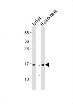Invitrogen EMP3 Polyclonal Antibody 400 &mu;L; Unconjugated:Antibodies,