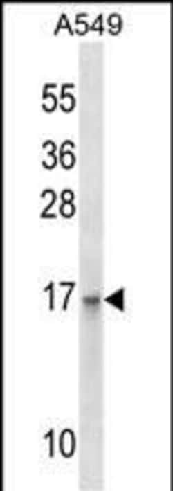 Invitrogen EMP3 Polyclonal Antibody 400 &mu;L; Unconjugated:Antibodies,