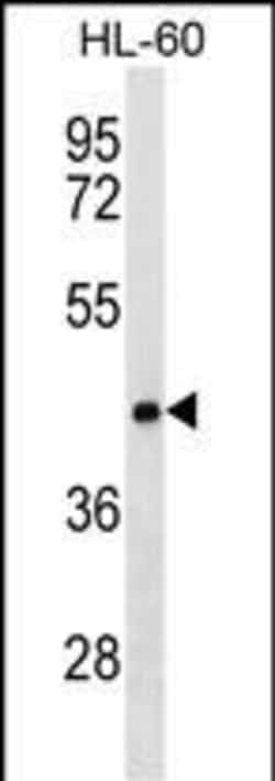 Invitrogen CLN8 Polyclonal Antibody 400 &mu;L; Unconjugated:Antibodies,