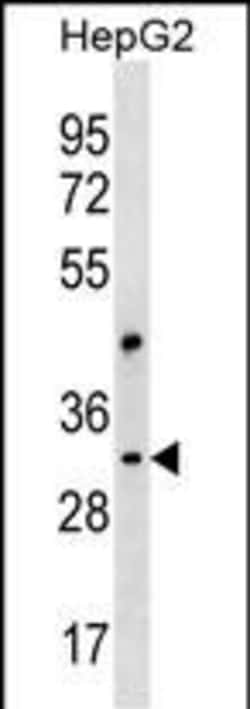 CEP170L Polyclonal Antibody 400 &mu;L | Buy Online | Thermo Scientific | Fisher Scientific