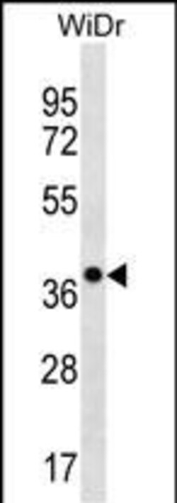 Invitrogen CLCA3P Polyclonal Antibody 400 &mu;L; Unconjugated:Antibodies,