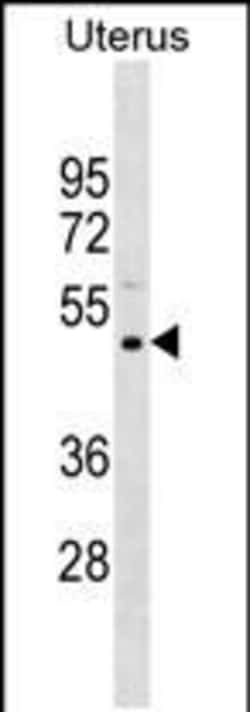 Invitrogen PRAMEF11 Polyclonal Antibody 400 &mu;L; Unconjugated:Antibodies,
