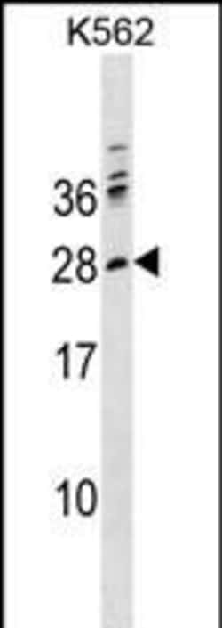 Invitrogen PTCRA Polyclonal Antibody 400 &mu;L; Unconjugated:Antibodies,