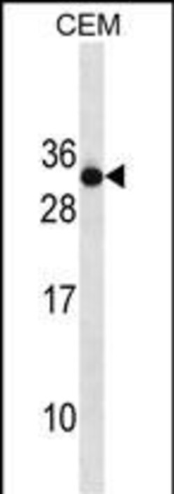 Invitrogen RAB4B Polyclonal Antibody 400 &mu;L | Buy Online | Invitrogen&trade; | Fisher Scientific