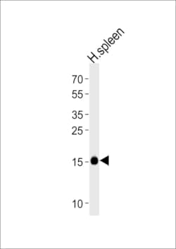 Invitrogen RNASE2 Polyclonal Antibody 400 &mu;L | Buy Online | Invitrogen&trade; | Fisher Scientific