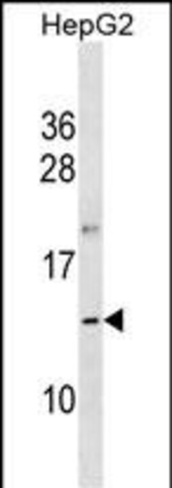 Invitrogen OOSP1 Polyclonal Antibody 400 &mu;L; Unconjugated:Antibodies,