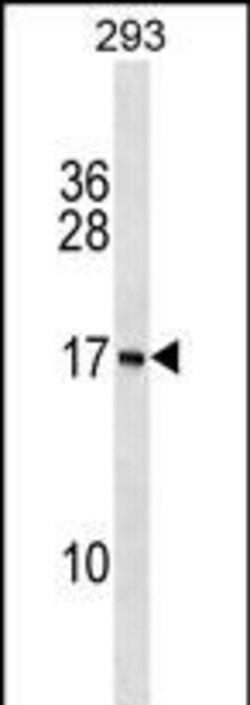 Invitrogen PAPPAS Polyclonal Antibody 400 &mu;L | Buy Online | Invitrogen&trade; | Fisher Scientific