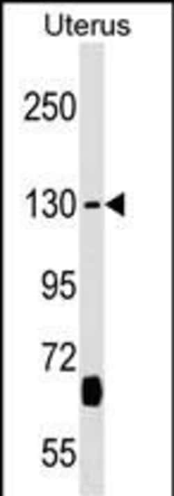 KIF27 Polyclonal Antibody:Antibodies, Polyclonal