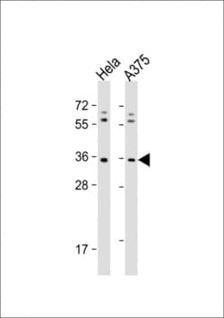 Invitrogen OR5AK2 Polyclonal Antibody 400 &mu;L; Unconjugated:Antibodies,