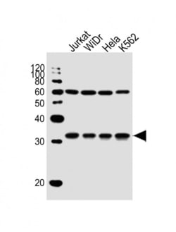 Invitrogen EXOSC6 Polyclonal Antibody 400 &mu;L; Unconjugated:Antibodies,