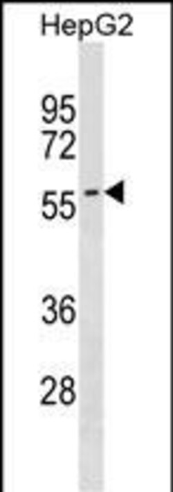 Invitrogen SMPD3 Polyclonal Antibody 400 &mu;L; Unconjugated:Antibodies,