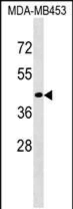 Invitrogen CD200R1L Polyclonal Antibody 400 &mu;L; Unconjugated:Antibodies,