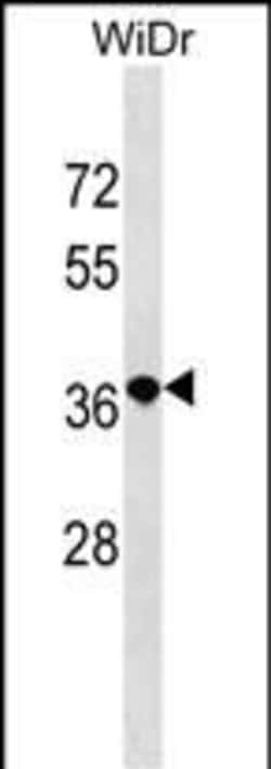 Invitrogen RRN3P2 Polyclonal Antibody 400 &mu;L; Unconjugated:Antibodies,