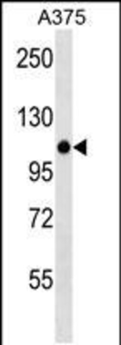 ZNF729 Polyclonal Antibody 400 &mu;L | Buy Online | Invitrogen | Fisher Scientific