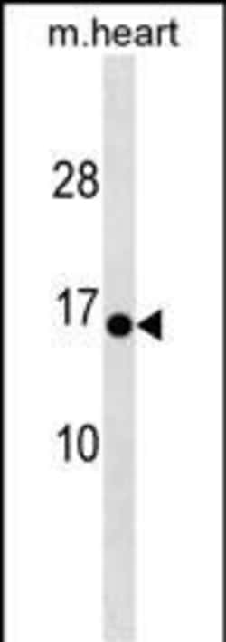 Invitrogen HIGD1C Polyclonal Antibody 400 &mu;L; Unconjugated:Antibodies,