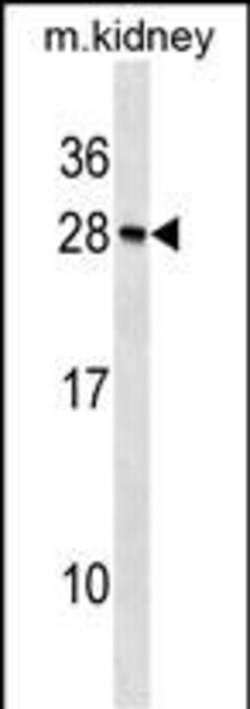 Invitrogen Recoverin Polyclonal Antibody 400 &mu;L; Unconjugated:Antikörper