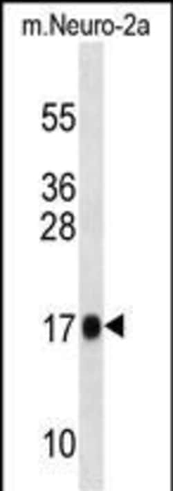 Invitrogen RPL13A Polyclonal Antibody 400 &mu;L; Unconjugated:Antibodies,
