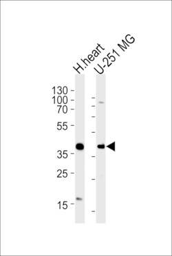AKTIP Polyclonal Antibody 400 &mu;L | Buy Online | Invitrogen | Fisher Scientific