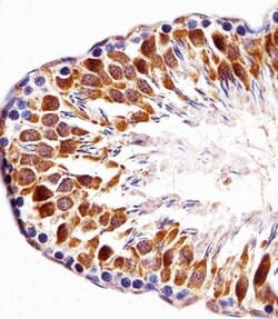 Invitrogen PBK Polyclonal Antibody 400 &mu;L; Unconjugated:Antibodies,