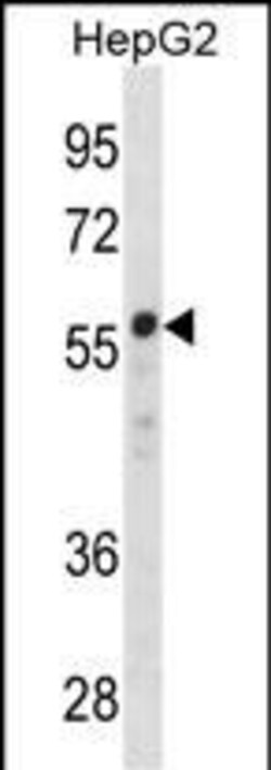 Invitrogen ZNF276 Polyclonal Antibody 400 &mu;L | Buy Online | Invitrogen&trade; | Fisher Scientific