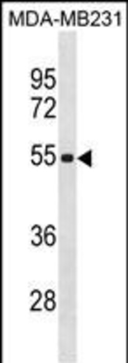 Invitrogen ZSCAN5C Polyclonal Antibody 400 &mu;L; Unconjugated:Antibodies,