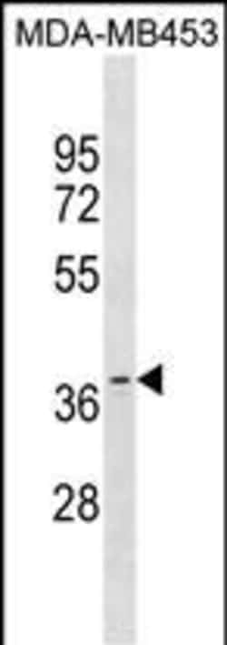 Invitrogen OR11A1 Polyclonal Antibody 400 &mu;L | Buy Online | Invitrogen&trade; | Fisher Scientific