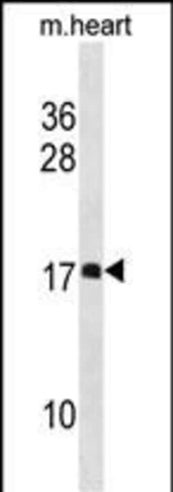 Invitrogen DAPL1 Polyclonal Antibody 400 &mu;L; Unconjugated:Antibodies,