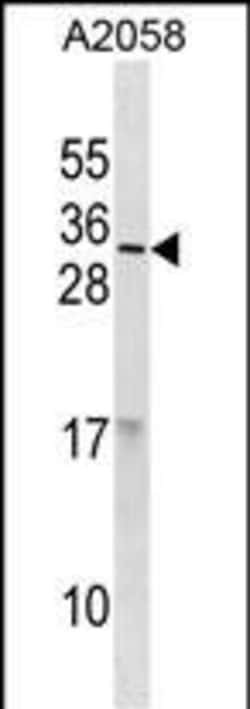 Invitrogen RNASE9 Polyclonal Antibody 400 &mu;L; Unconjugated:Antibodies,