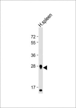 Invitrogen PRSSL1 Polyclonal Antibody 400 &mu;L; Unconjugated:Antibodies,