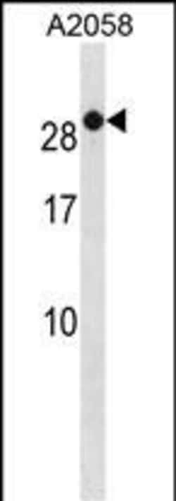 RAB7B Polyclonal Antibody:Antibodies, Polyclonal