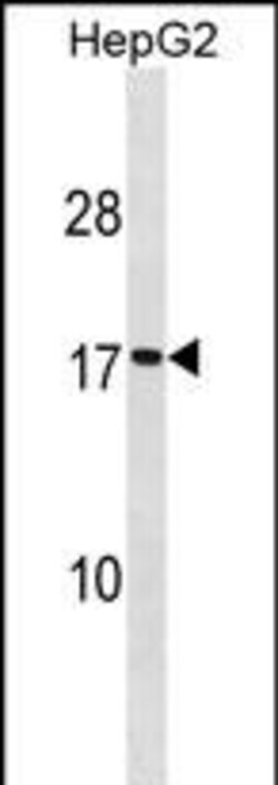 Invitrogen SEC11A Polyclonal Antibody 400 &mu;L; Unconjugated:Antibodies,