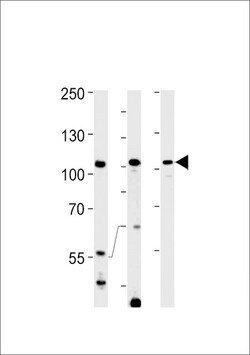 Invitrogen TFIP11 Polyclonal Antibody 400 &mu;L; Unconjugated:Antibodies,