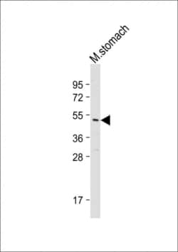 Invitrogen TXNIP Polyclonal Antibody 400 &mu;L; Unconjugated:Antibodies,