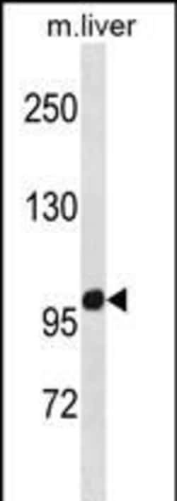 ZNF865 Polyclonal Antibody:Antibodies, Polyclonal