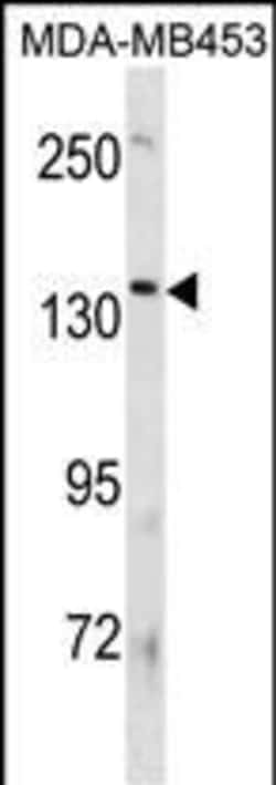 Invitrogen ATP8B3 Polyclonal Antibody 400 &mu;L; Unconjugated:Antibodies,