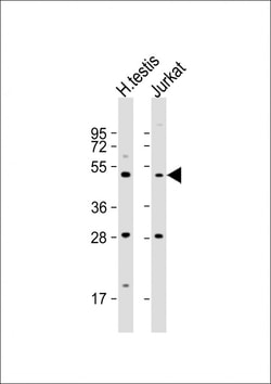 Invitrogen OXCT2 Polyclonal Antibody 400 &mu;L; Unconjugated:Antibodies,