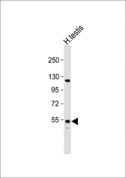Invitrogen GOLGA6L2 Polyclonal Antibody 400 &mu;L; Unconjugated:Antibodies,