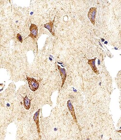 Invitrogen MYH14 Polyclonal Antibody 400 &mu;L | Buy Online | Invitrogen&trade; | Fisher Scientific