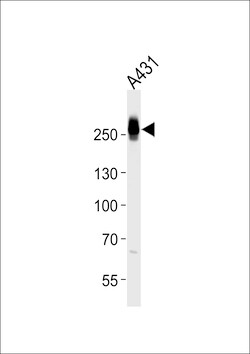 Invitrogen MYH14 Polyclonal Antibody 400 &mu;L | Buy Online | Invitrogen&trade; | Fisher Scientific