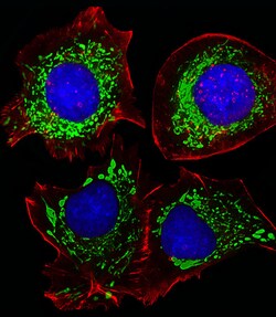 Adenylate Kinase 4 Polyclonal Antibody:Antibodies, Polyclonal